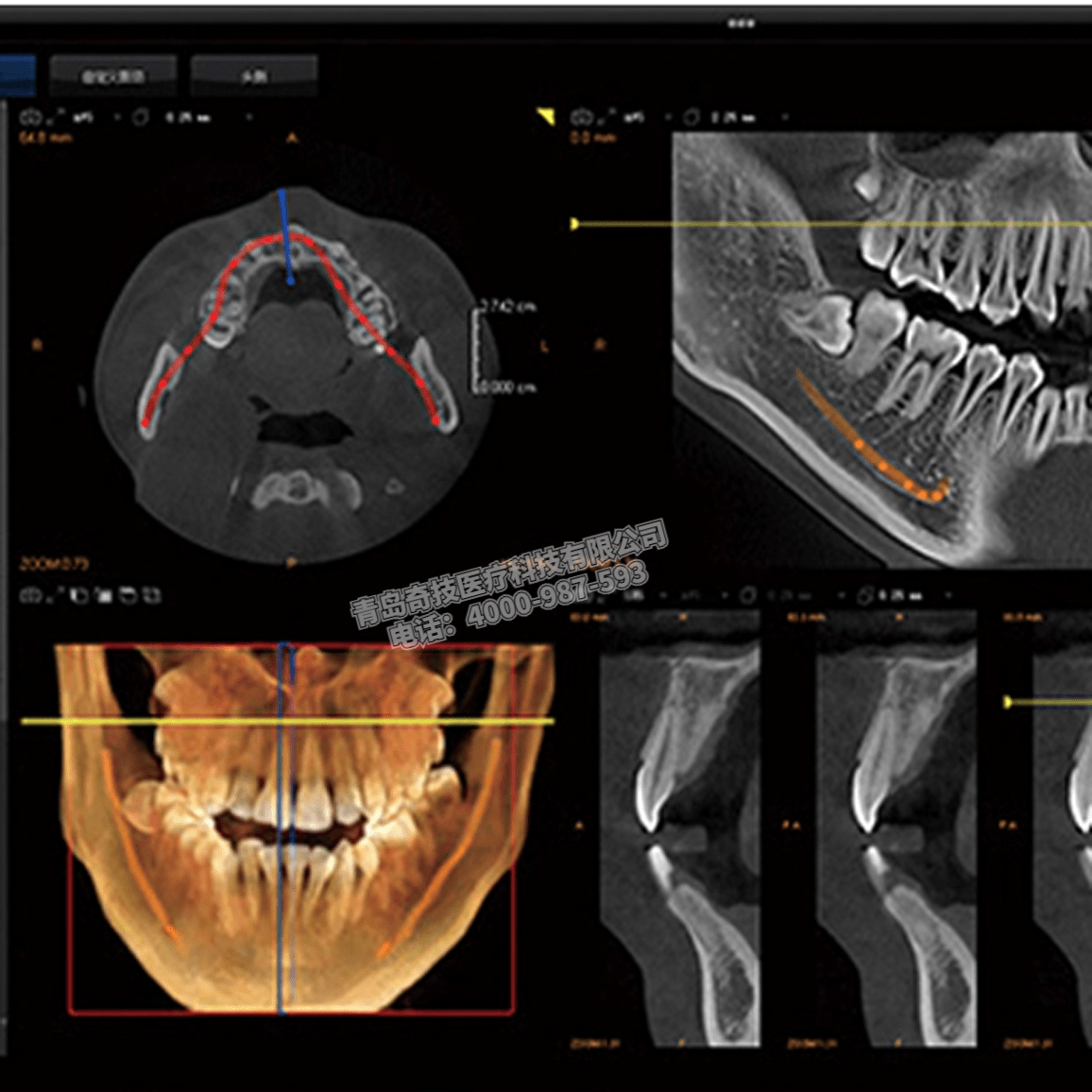 ĿǻCBCT ǻȫڷɭƷܴҰ