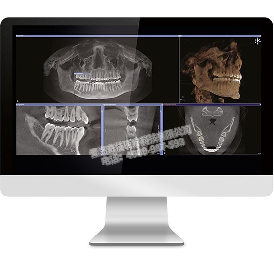 ؿǻCBCT ǻȫ¹ŵ²Ʒ