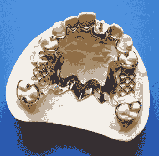 怀柔不锈钢骨科器械-激光焊接加工电话